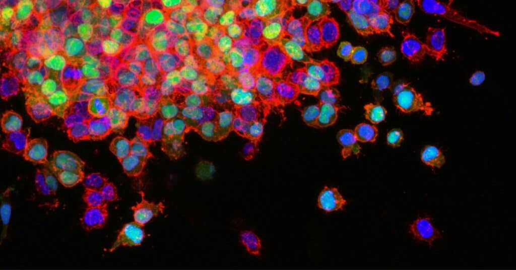 Many Cancer Drugs Still Unproven 5 Years After Accelerated Approval