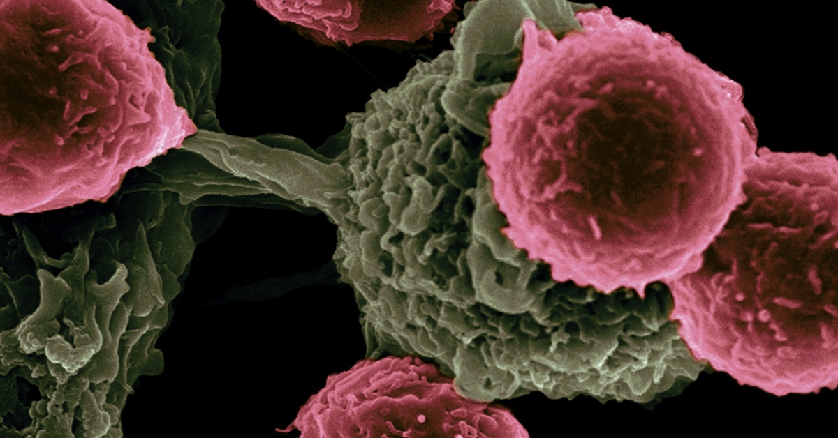 The National Cancer Institite's photo of Cancer Cells.